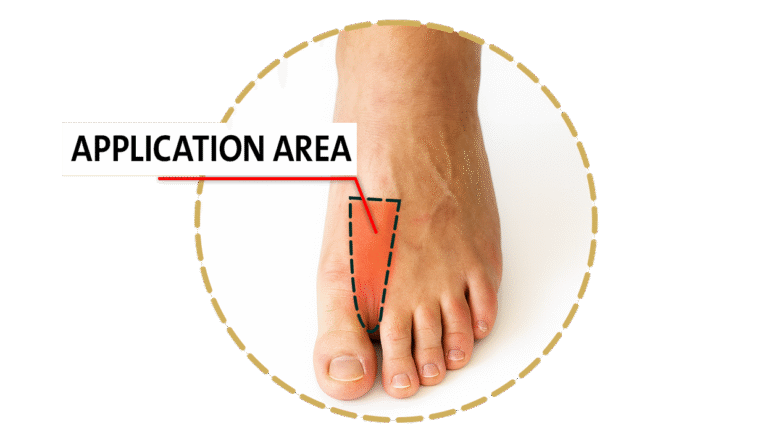 Application area leg